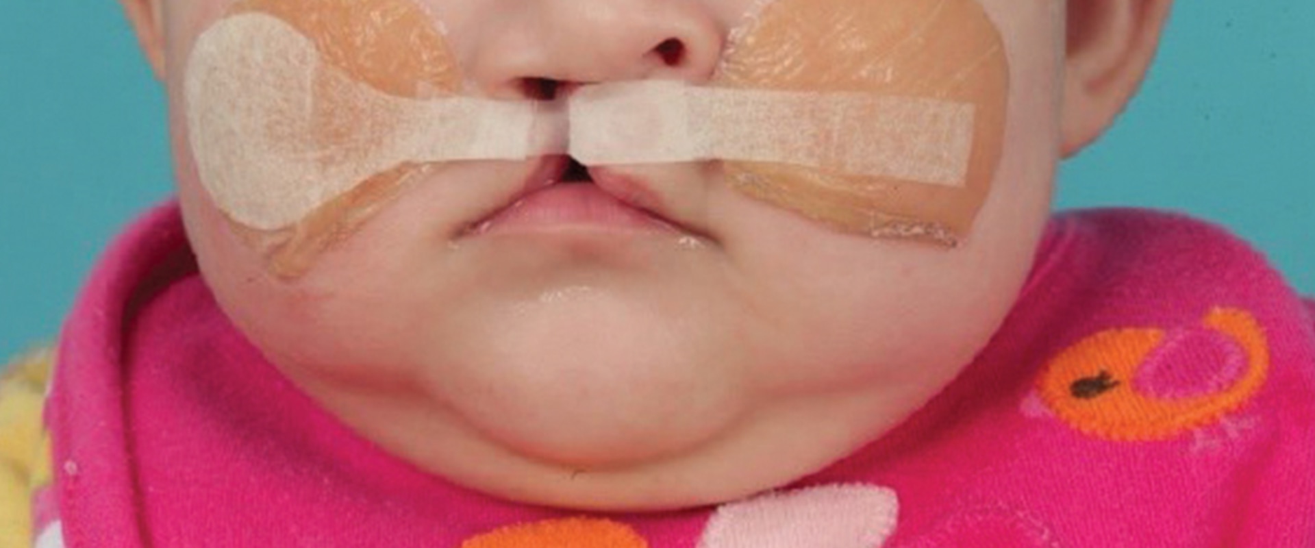 Do Dentists Treat Lips? An Expert's Guide