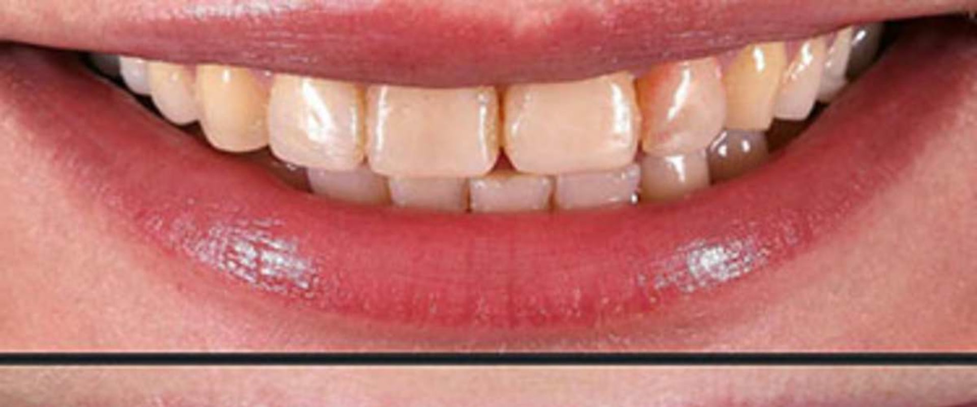 The Art of Cosmetic Dentistry in India: Cost, Procedures and Destinations
