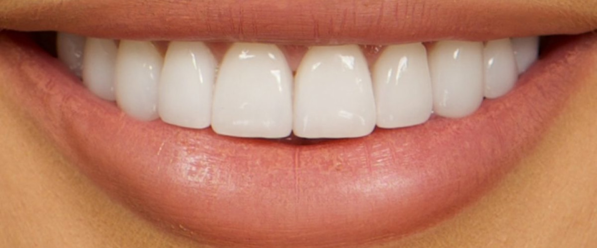 Who is the Kardashian Cosmetic Dentist?