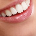 Achieve the Perfect Smile with Cosmetic Dentistry