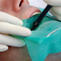 Is a Root Canal Treatment a Surgical Procedure?
