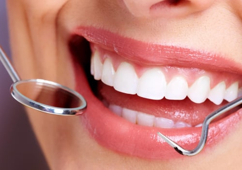 What is a Private Cosmetic Dentist?