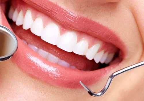 What Procedures Do Cosmetic Dentists Do?